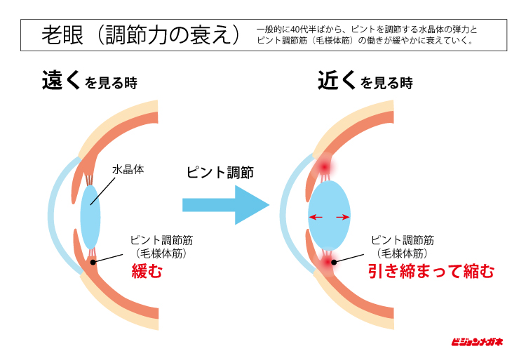 老眼「調節力の衰え」"